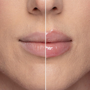Lippenfüller I Vitamin E Lippen auffüllendes Serum
